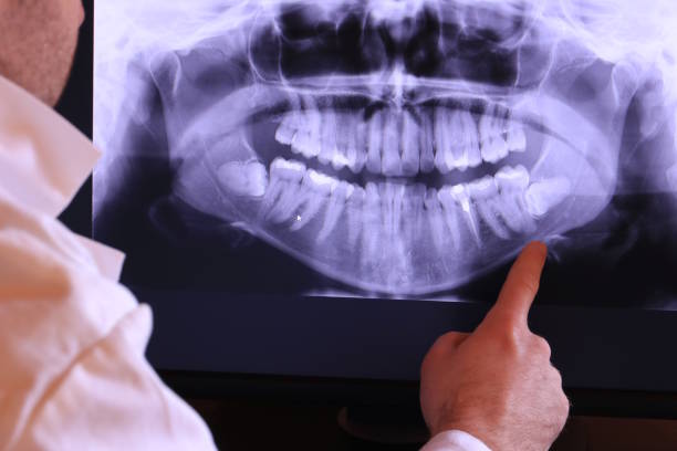 Best Emergency Tooth Extraction in Halstead, KS